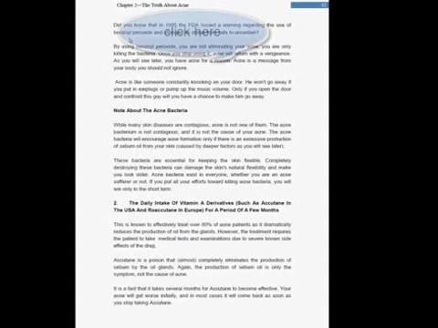 Acne No More System Review - Acne No More By Mike Walden Video