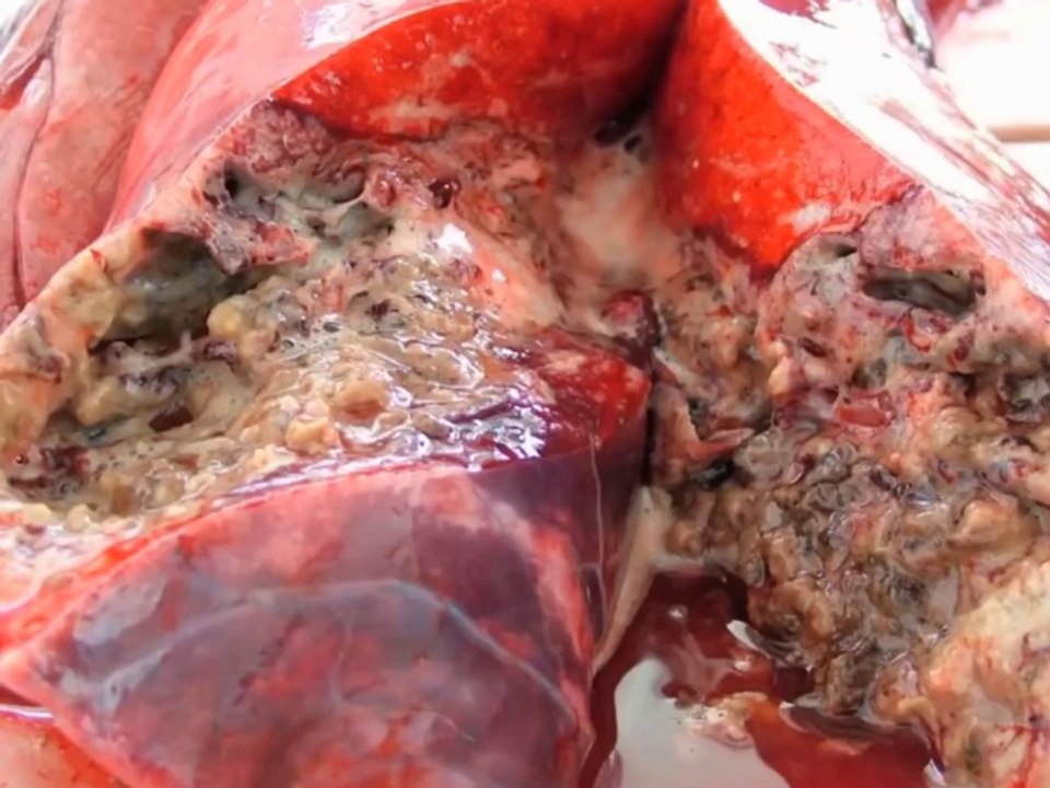What's Happens To The Lungs While Smoking