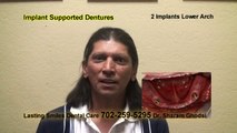 ▶ Implant Denture Video Testimonial - Las Vegas