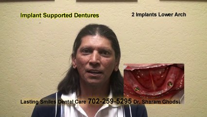 ▶ Implant Denture Video Testimonial - Las Vegas