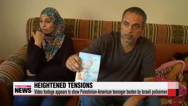 U.S. calls for investigation into beating of Palestinian-American teen
