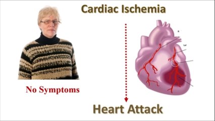 A Point-of-Care Test (POCT) for the early detection of ischemia and a heart attack