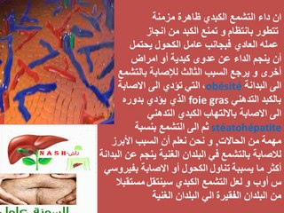 Cirrhose en général , cirrhose biliaire primitive, en particulier-1