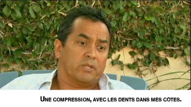 Mordu par un requin, un Californien raconte son attaque