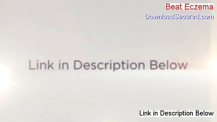 Beat Eczema Reviewed (Watch this)