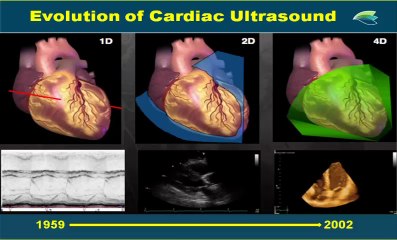 Nouveautés techniques, nouvelles modalités en échocardiographie. Dr.Elie CHammas
