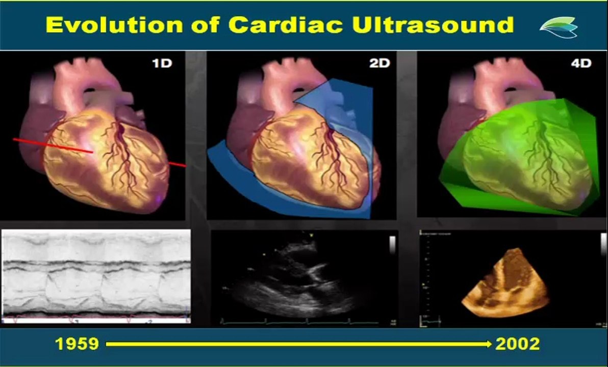 Nouveautés techniques, nouvelles modalités en échocardiographie. Dr.Elie CHammas