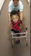 Les premiers pas d'un enfant amputé d'une jambe : quel courage!