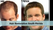 Dr. Glenn M. Charles, DO Best Hair Surgeon in FL