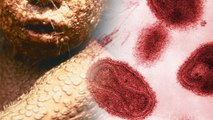 Scientists Find Forgotten Smallpox Vials Found In Old FDA Storage Room