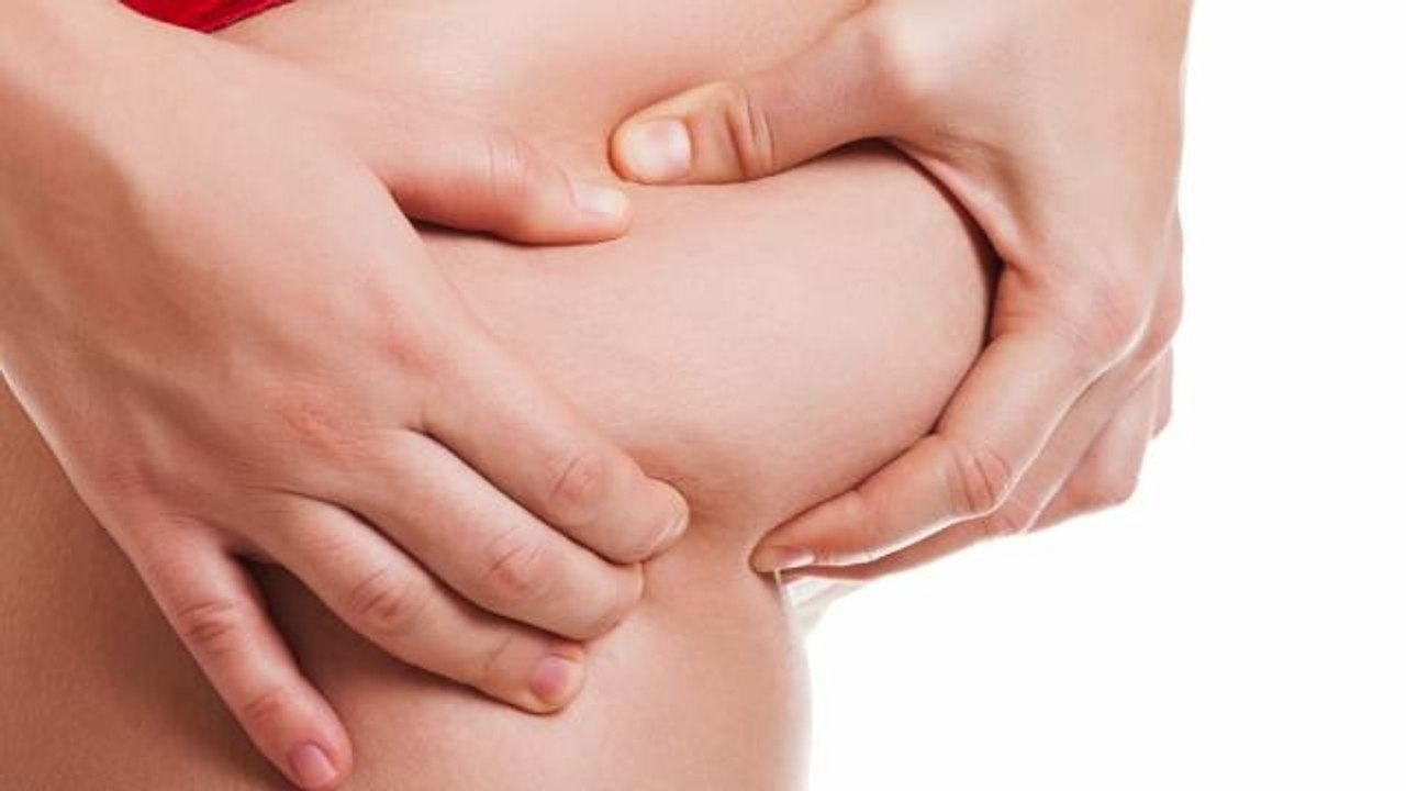 Facts and Myths About Cellulite
