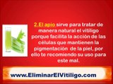 Remedios Caseros Para Curar El Vitiligo - recetas caseras para el vitiligo