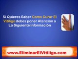 Como Curar El Vitiligo - remedios caseros para combatir el vitiligo