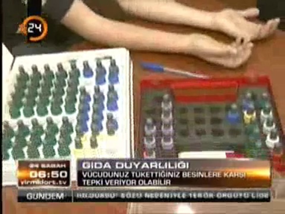 Alerji Uzmanı Dr. Emin Özkaya Gıda Duyarlılığını anlatıyor