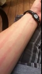 REAL DEMONIC SCRATCHES