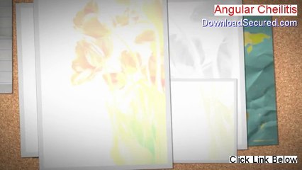 Angular Cheilitis PDF Download - Legit Download