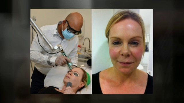 Tummy Tuck Beverly Hills