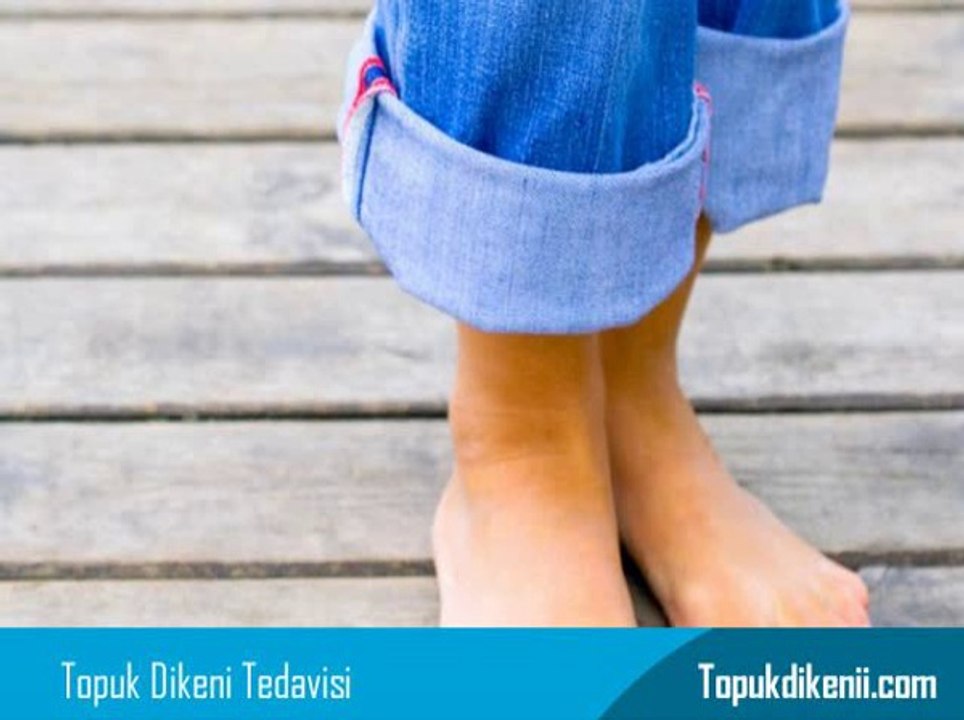 Topuk Dikeni Hangi Doktor Bakar