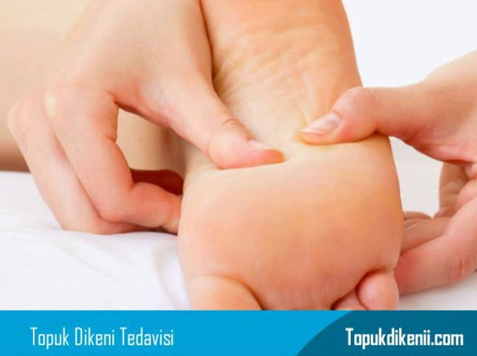 Topuk Dikeni Nasıl Kırılır