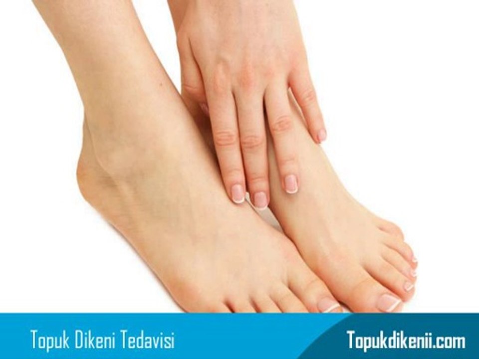 Topuk Dikeni Kırma İzle