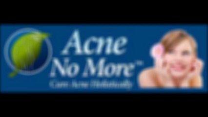 Acne No More Removing