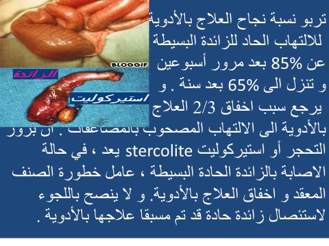 APPENDICITE,appendicectomie,traitement,diagnosic,chirurgie et médicaments