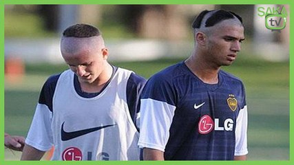 Sacı Şekil Olan Çocugun Dramı