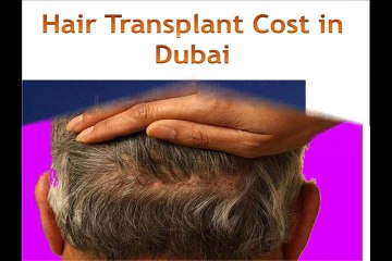 FUT Hair Transplant in Dubai