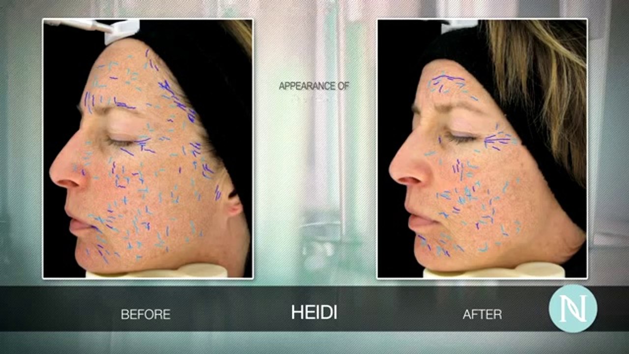 Conclusive Evidence That Nerium Does Work