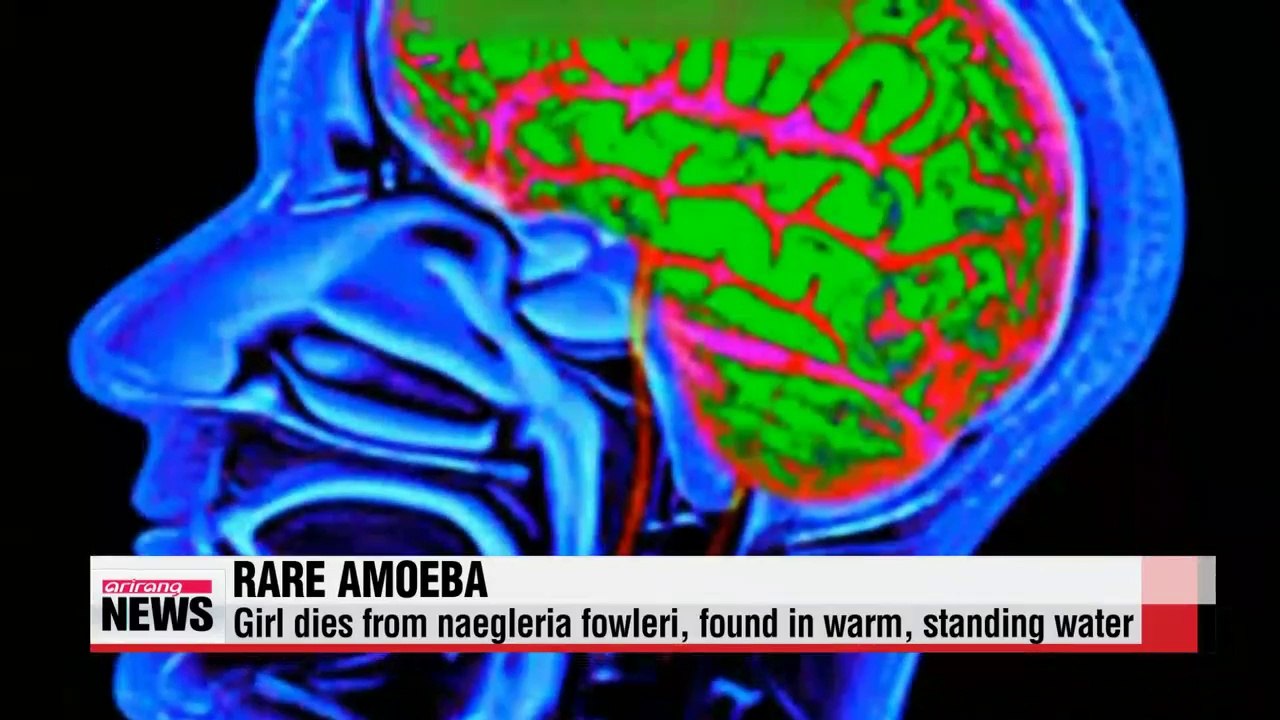 Girl dies from brain-eating amoeba