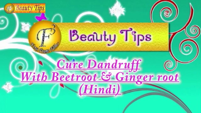 Home Remedy of Beetroot to get rid of the biggest hair problem Dandruff