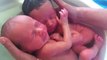 Twin Babies Think They Are Still In The Womb