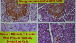 ICHN-2014 Clinical and Therapeutic Nutrition An extract from date seeds stimulus endogenous insulin secretion in type 1 Diabetic Rats Prof. Dr. Ahmed El Fouhil-cut
