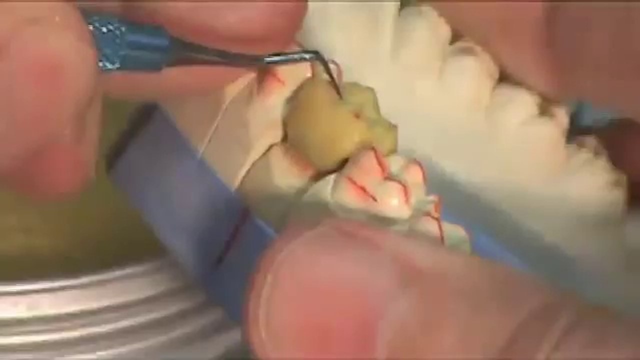 PTC WC-1 and WC-2 Wax Carver