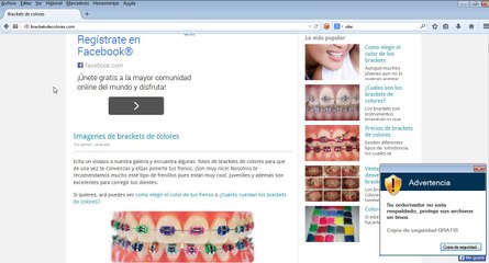 los brackets mas caros del mundo