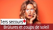 Soigner ses coups de soleil : Brûlures, les premiers soins