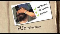 FUE hair transplant expert in pakistan,FUE vs FUT pakistan,FUE in Pakistan