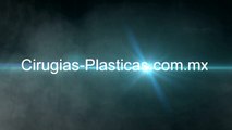 Cirugias Plasticas de Cara - Cirugia Plastica de Ojos, Piernas