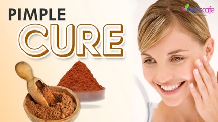 Natural Home Remedy For Pimples and Acnes