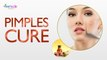 Cure Pimples and Cystic Acnes Naturally at Home