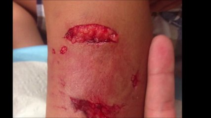 Un chien attaque sauvagement un enfant de 4 ans, son chat le défend !