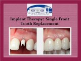 Treatments & Results of Dental Therapy