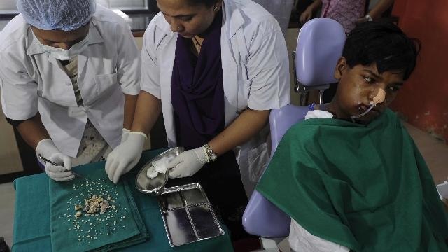 Doctors Remove 232 Teeth From Teen's Mouth
