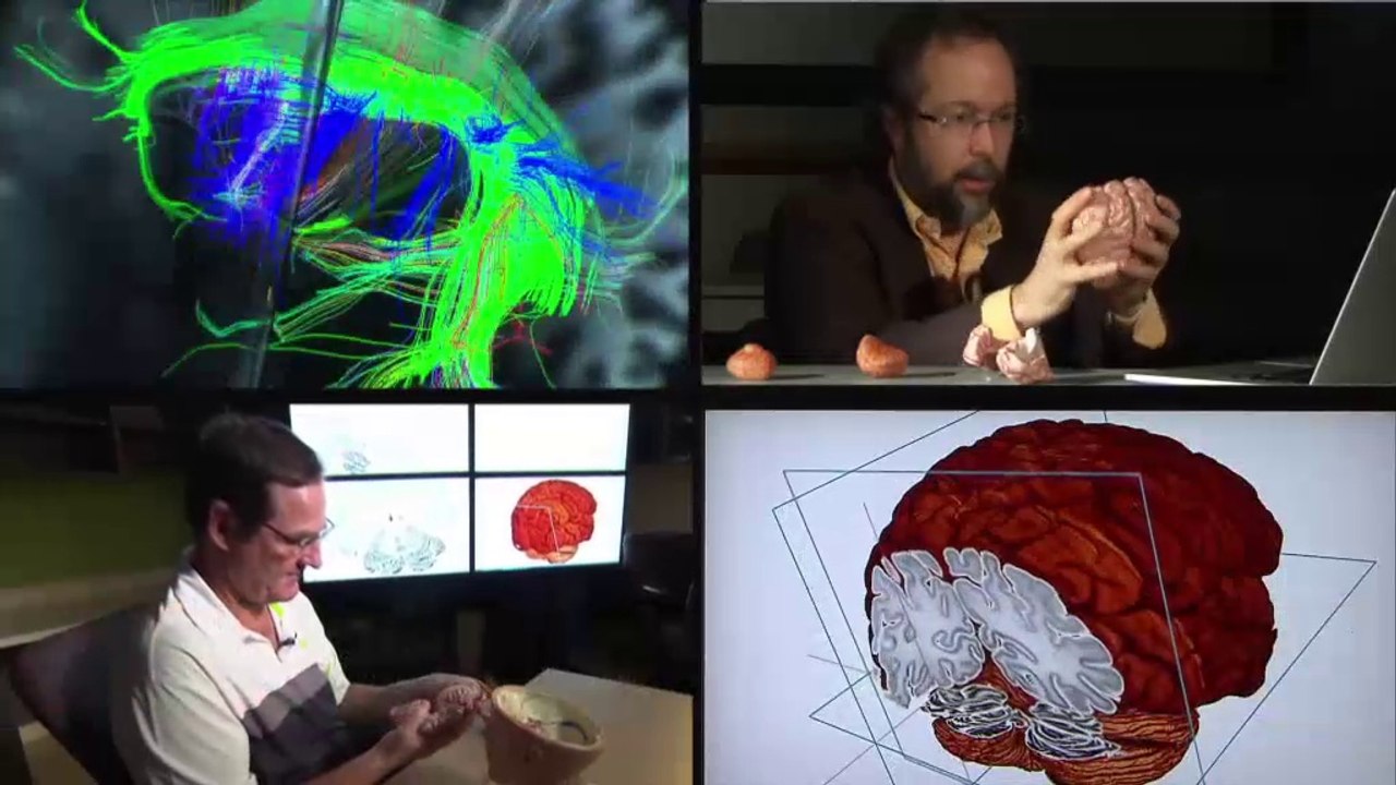 L'odyssée du cerveau