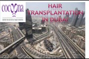 FUE Hair Transplant Clinic Dubai