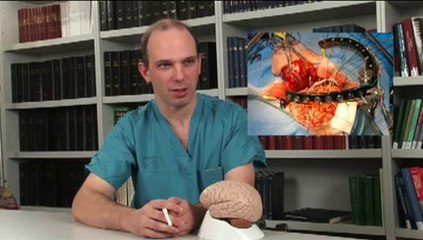 Sudhir Gopi Holdings Dubai  --  Interview with Jeffrey Ojemann, M.D., neurosurgeon