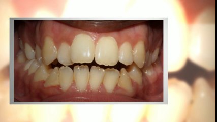 Dallas Orthodontist July2014