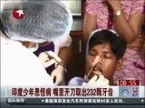 232 dents retiré de la bouche d'un garçon en Inde
