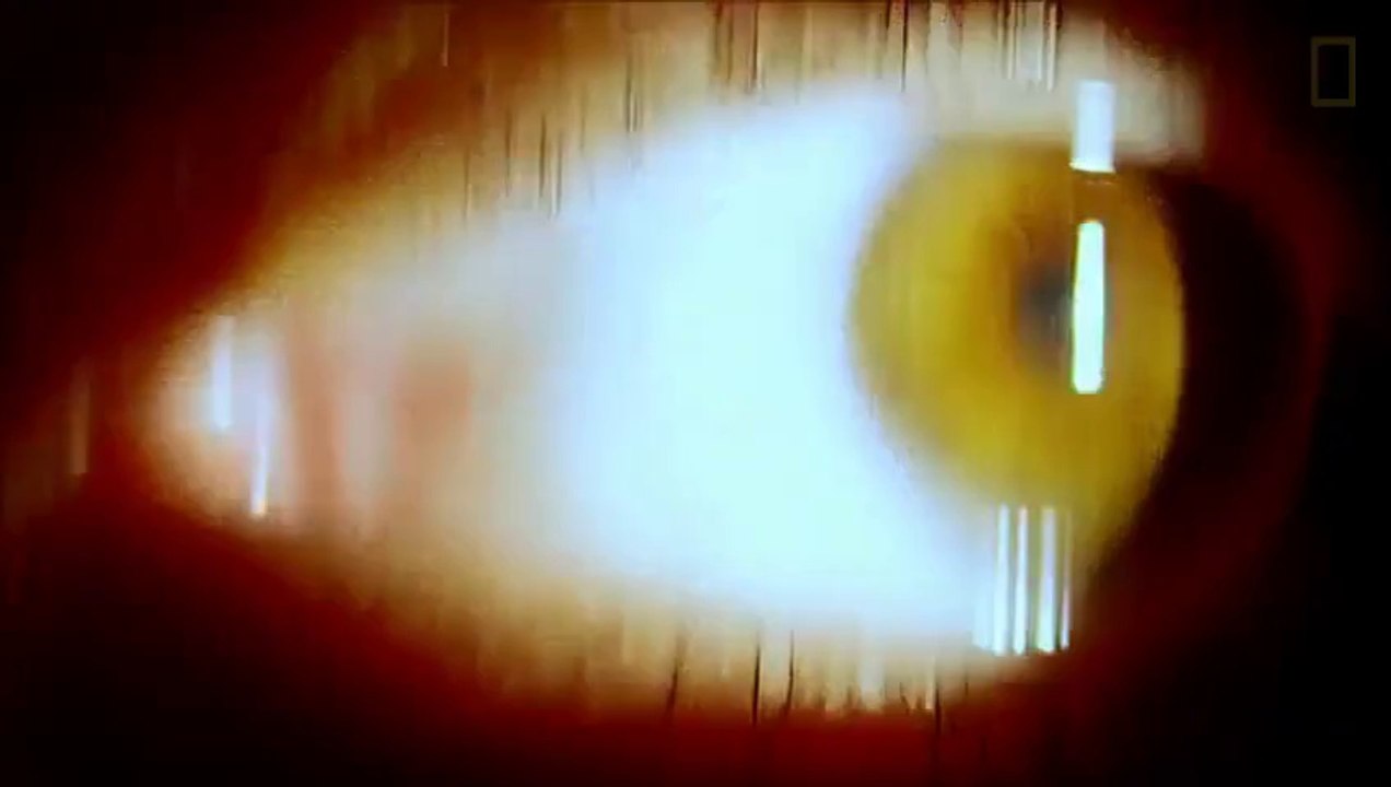 Eye-1