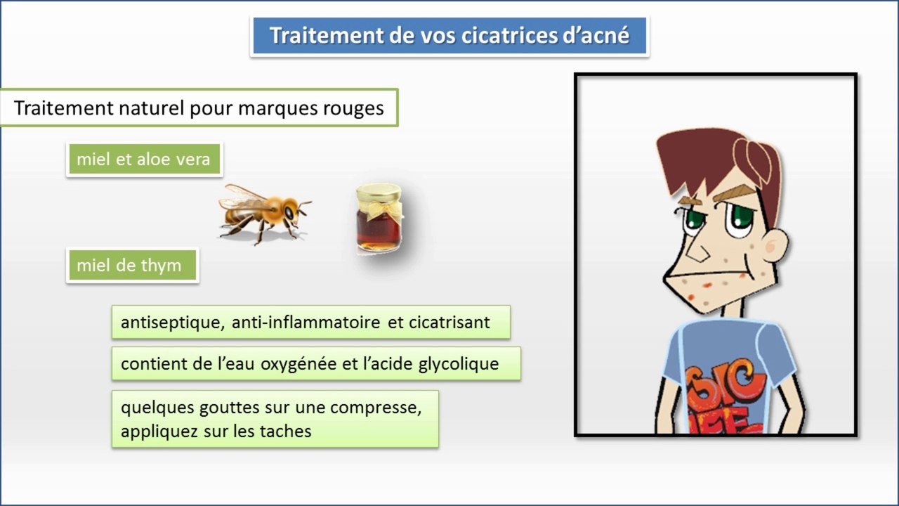 Quels sont les symptômes de l’acné ?